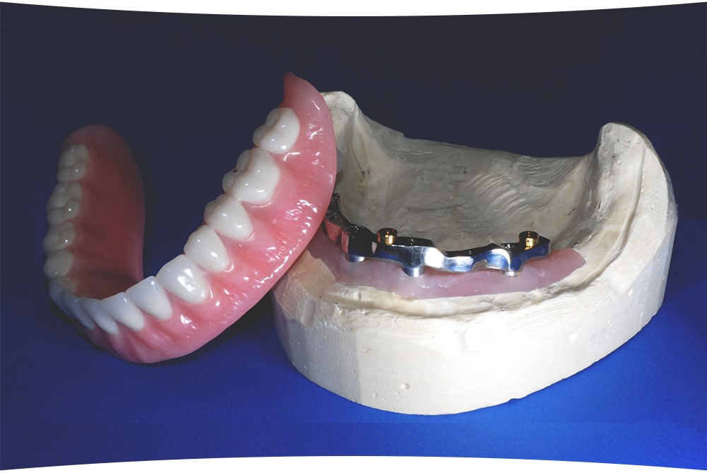 Beading And Boxing Dentures Riggins ID 83549